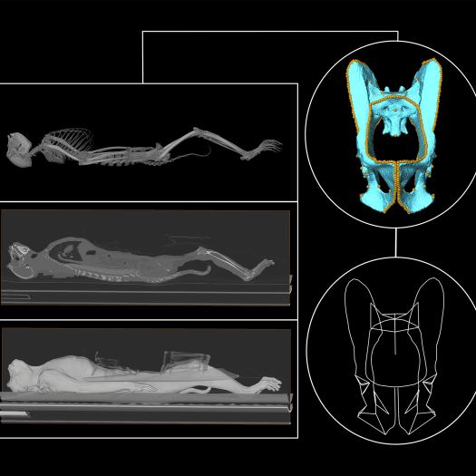 ltbuck_pelvis_workflow2.png
