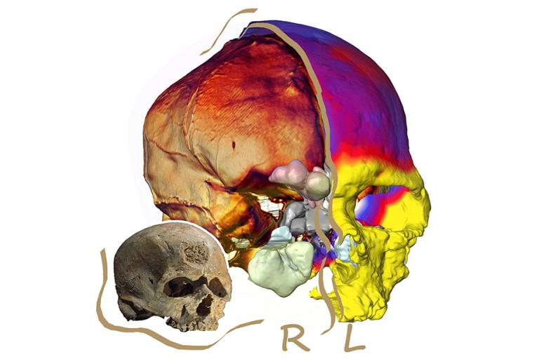 1-cmasymmetry.jpg